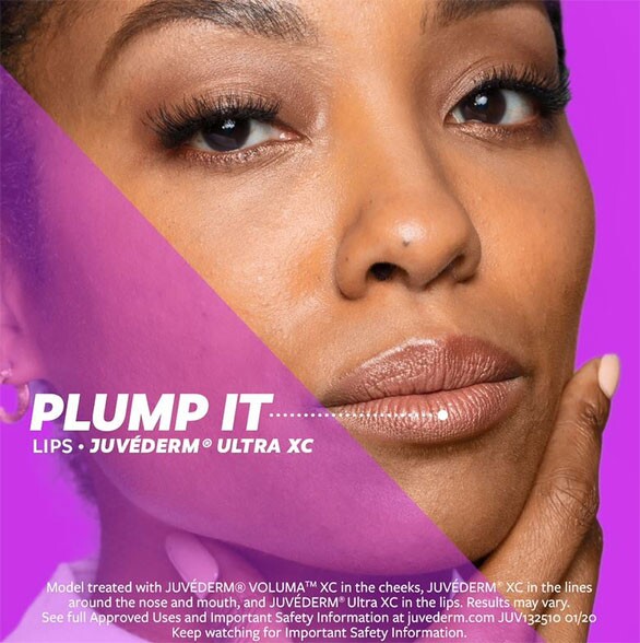 juvederm